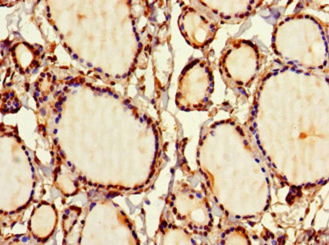 Immunohistochemistry of paraffin-embedded human thyroid tissue using CSB-PA021335LA01HU at dilution of 1:100