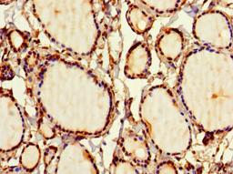 Immunohistochemistry of paraffin-embedded human thyroid tissue using CSB-PA021335LA01HU at dilution of 1:100