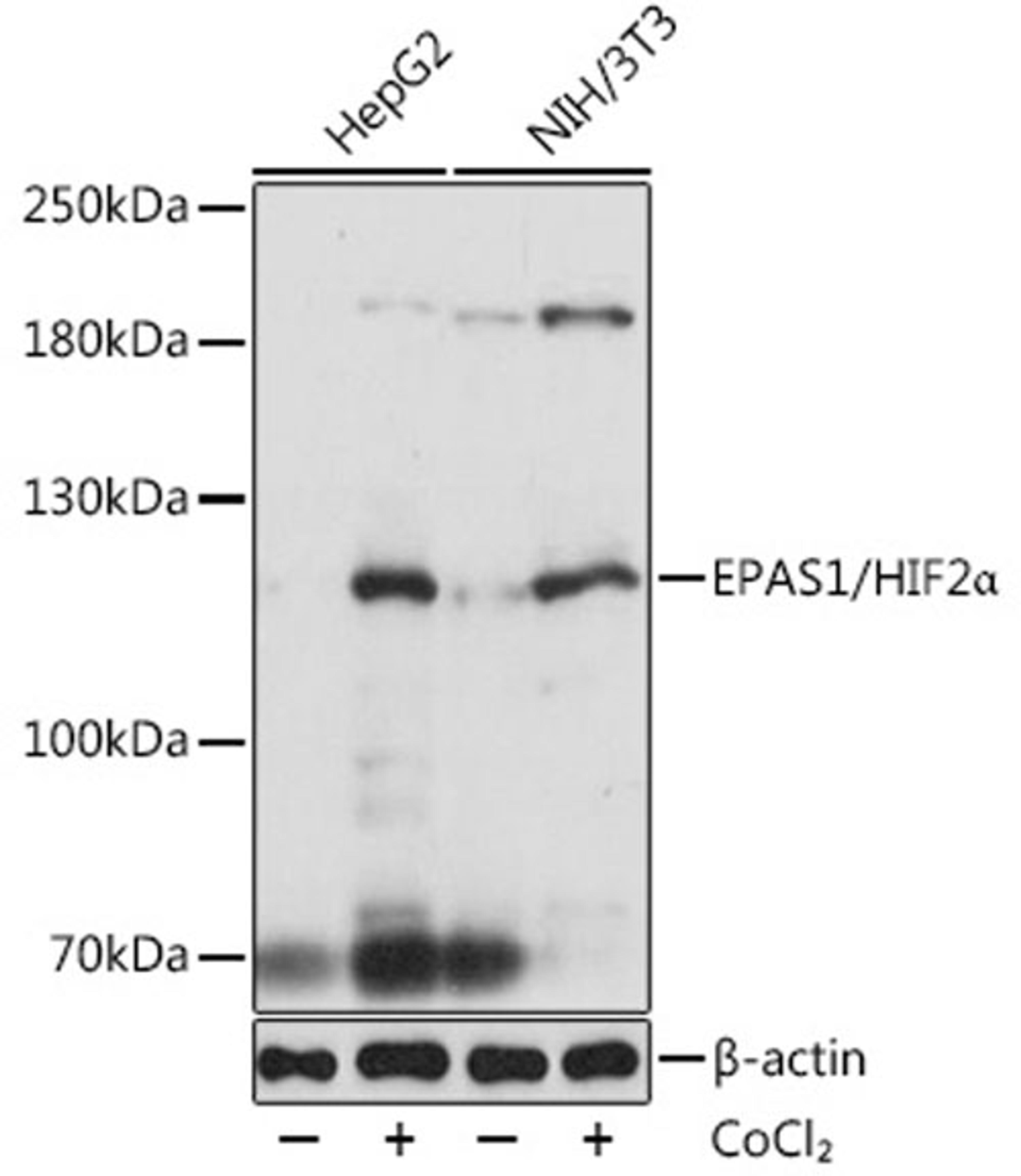 Western blot - EPAS1/HIF2a antibody (A7553)