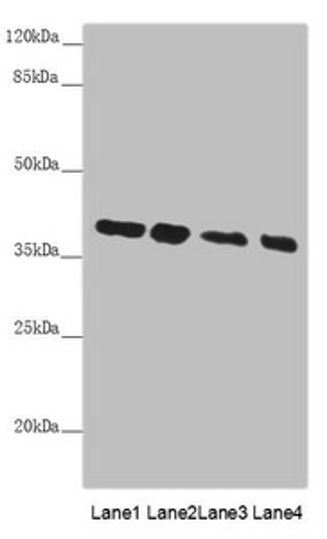 Western blot. All lanes: PPP1R8 antibody at 4.73µg/ml. Lane 1: PC-3 whole cell lysate. Lane 2: HL60 whole cell lysate. Lane 3: HepG2 whole cell lysate. Lane 4: Hela whole cell lysate. Secondary. Goat polyclonal to rabbit IgG at 1/10000 dilution. Predicted band size: 39, 23, 14 kDa. Observed band size: 39 kDa