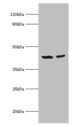 Western blot. All lanes: Short-chain specific acyl-CoA dehydrogenase, mitochondrial antibody at 7ug/ml. Lane 1: 293T whole cell lysate. Lane 2: HepG2 whole cell lysate. Secondary. Goat polyclonal to rabbit IgG at 1/10000 dilution. Predicted band size: 44 kDa. Observed band size: 44 kDa. 