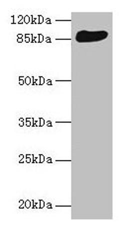 Western blot. All lanes: THAP12 antibody at 10µg/ml + HepG2 whole cell lysate. Secondary. Goat polyclonal to rabbit IgG at 1/10000 dilution. Predicted band size: 88, 57 kDa. Observed band size: 88 kDa