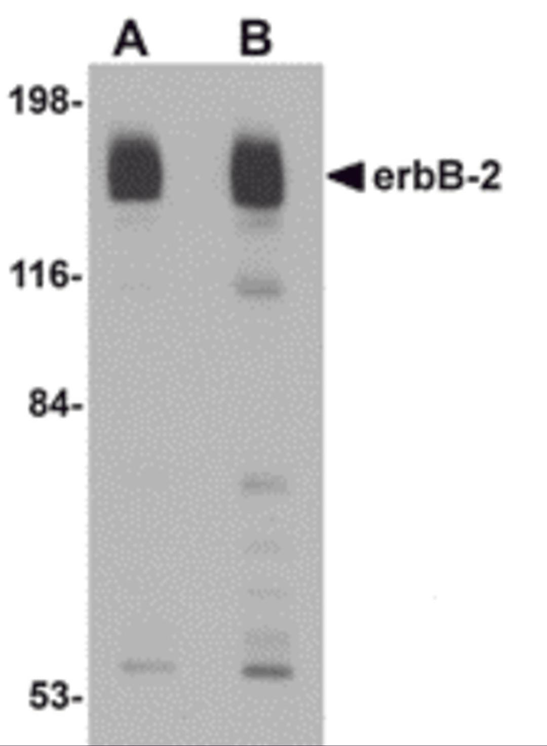 Western blot analysis of erbB-2 in rat liver tissue lysate with erbB-2 antibody at (A) 1 and (B) 2 μg/mL.