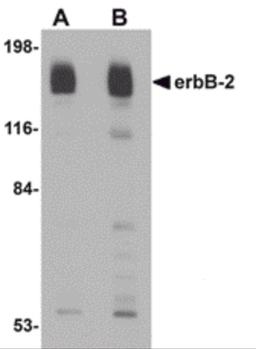 Western blot analysis of erbB-2 in rat liver tissue lysate with erbB-2 antibody at (A) 1 and (B) 2 μg/mL.