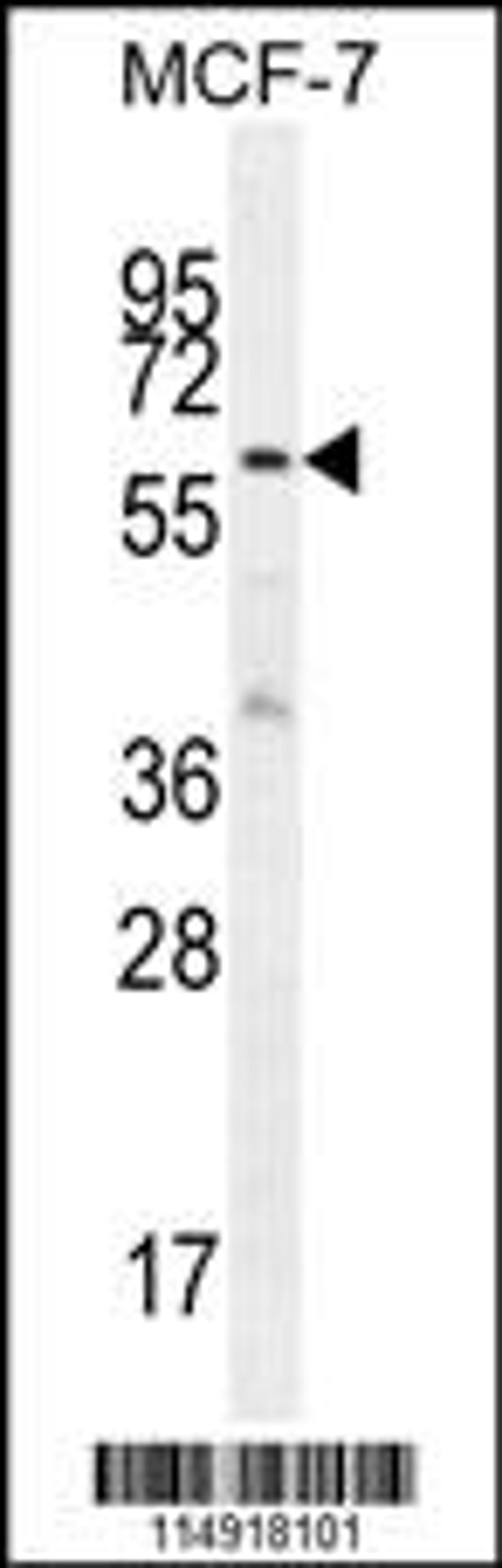 Western blot analysis in MCF-7 cell line lysates (35ug/lane).