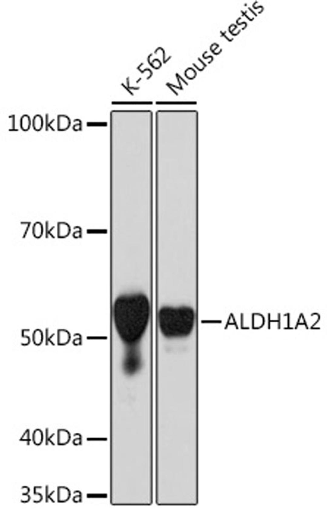 Western blot - ALDH1A2 Rabbit mAb (A9123)