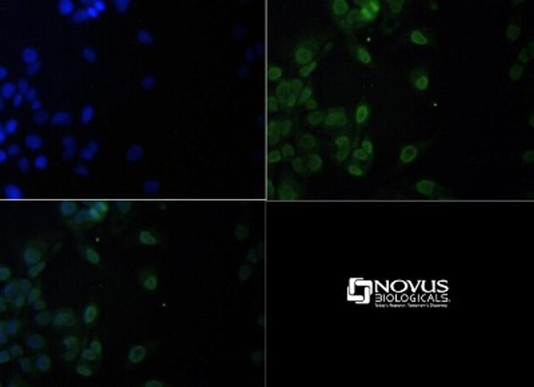 Immunocytochemistry/Immunofluorescence: c11orf59/LAMTOR1 Antibody [NBP1-71689] - C11orf59 antibody was tested at 1:50 in HepG2 cells with FITC (green). Nuclei (Blue) were counterstained with Dapi (blue).