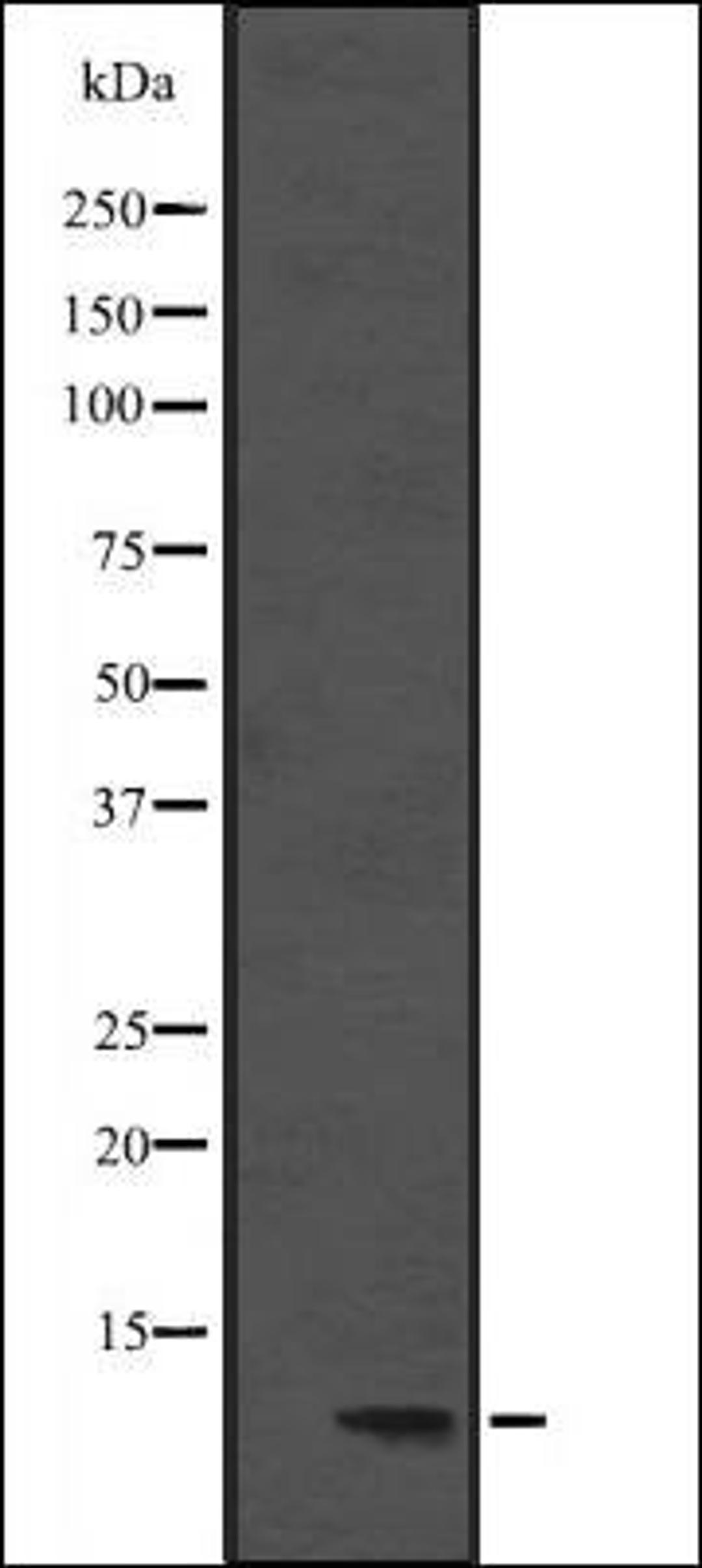 Western blot analysis of Hela cell lysate using DYNLL1 antibody