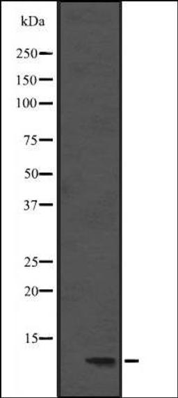 Western blot analysis of Hela cell lysate using DYNLL1 antibody