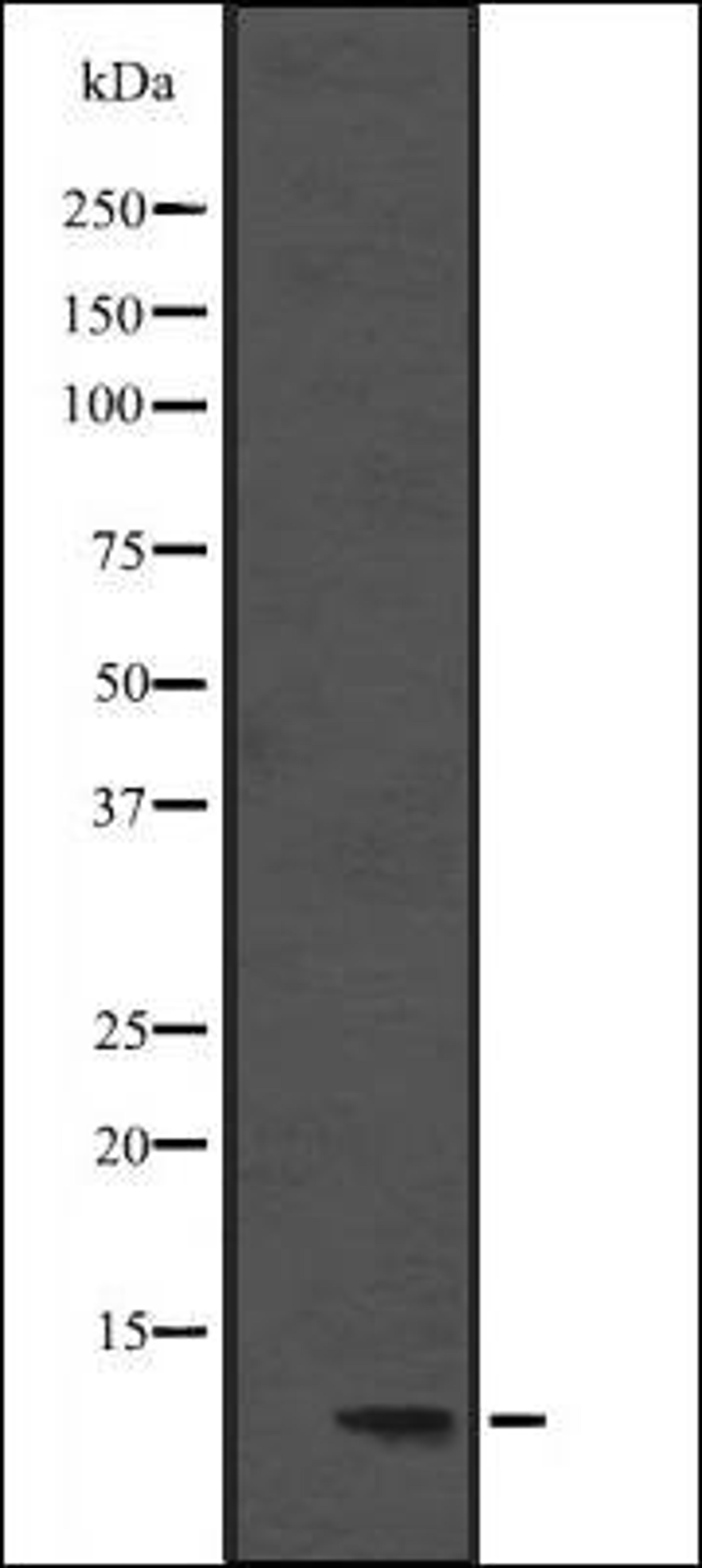 Western blot analysis of Hela cell lysate using DYNLL1 antibody