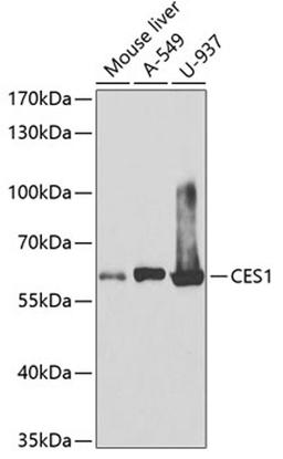 Western blot - CES1 antibody (A1853)