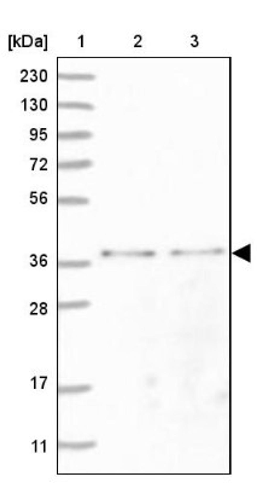 Western Blot: MTHFD2L Antibody [NBP1-82663] - Lane 1: Marker [kDa] 230, 130, 95, 72, 56, 36, 28, 17, 11<br/>Lane 2: Human cell line RT-4<br/>Lane 3: Human cell line U-251MG sp