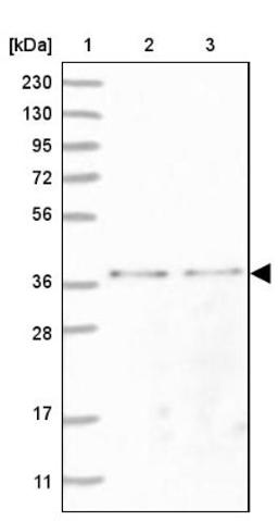 Western Blot: MTHFD2L Antibody [NBP1-82663] - Lane 1: Marker [kDa] 230, 130, 95, 72, 56, 36, 28, 17, 11<br/>Lane 2: Human cell line RT-4<br/>Lane 3: Human cell line U-251MG sp