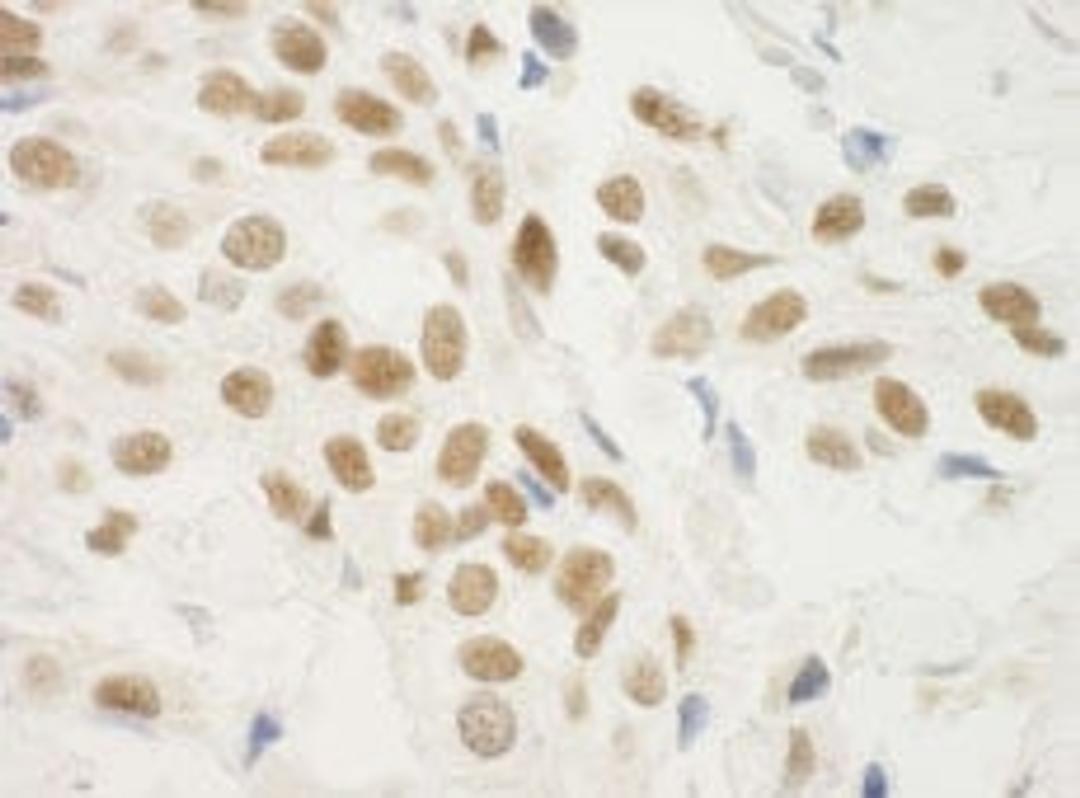 Detection of human ZNF768 by immunohistochemistry.