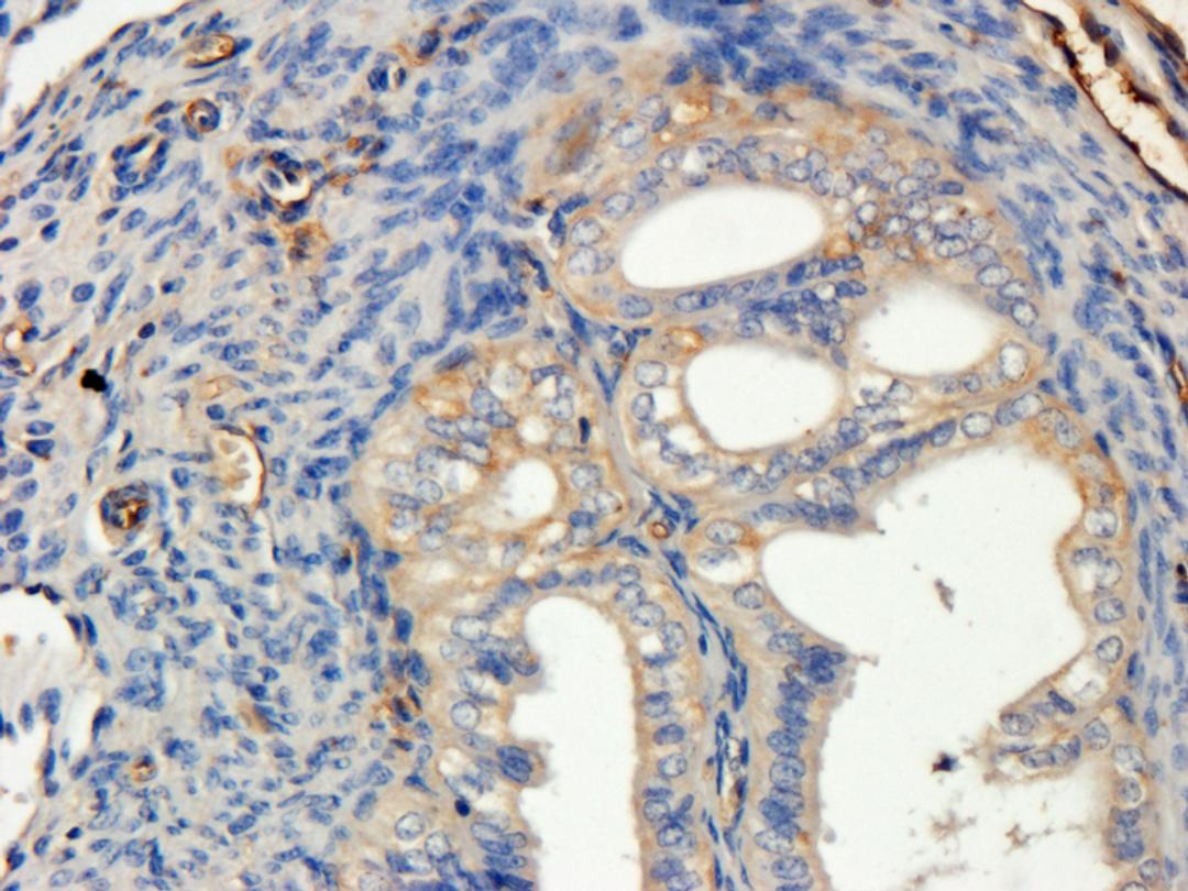 IHC-P image of mouse ovary tissue using anti-PHEX (dilution of primary antibody at 2.5 ug/ml)