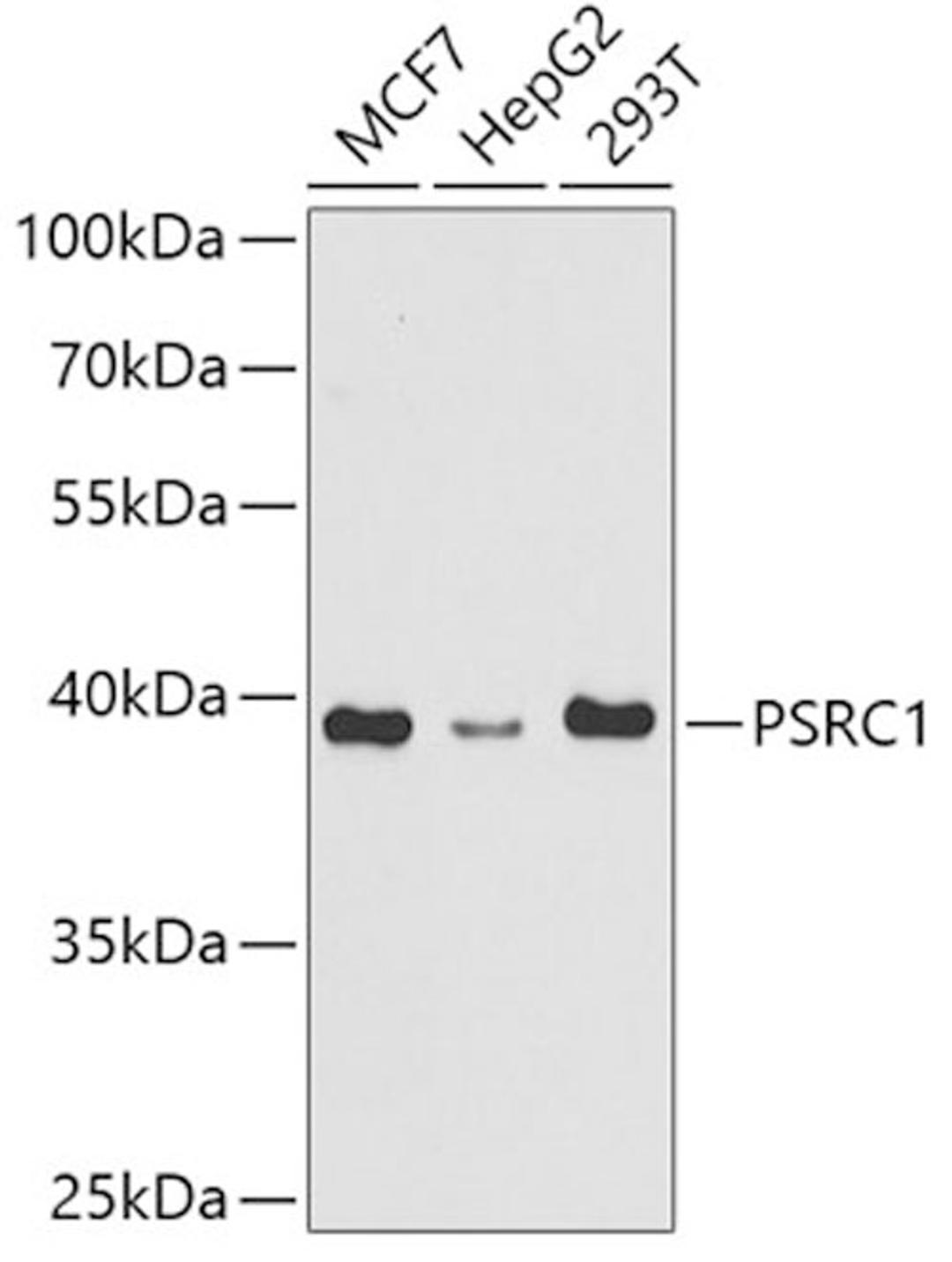 Western blot - PSRC1 antibody (A5484)