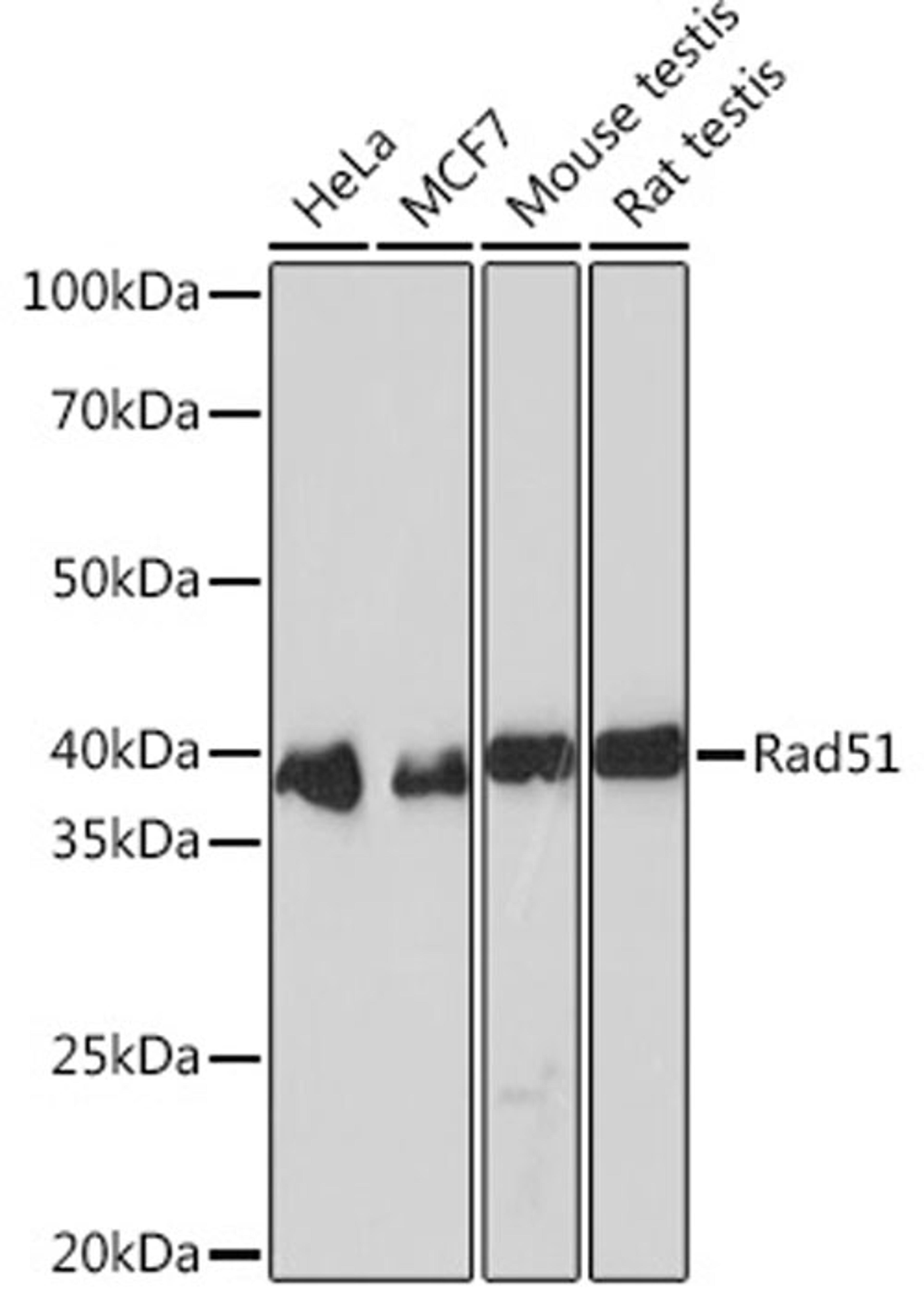 Western blot - Rad51 Rabbit mAb (A2829)