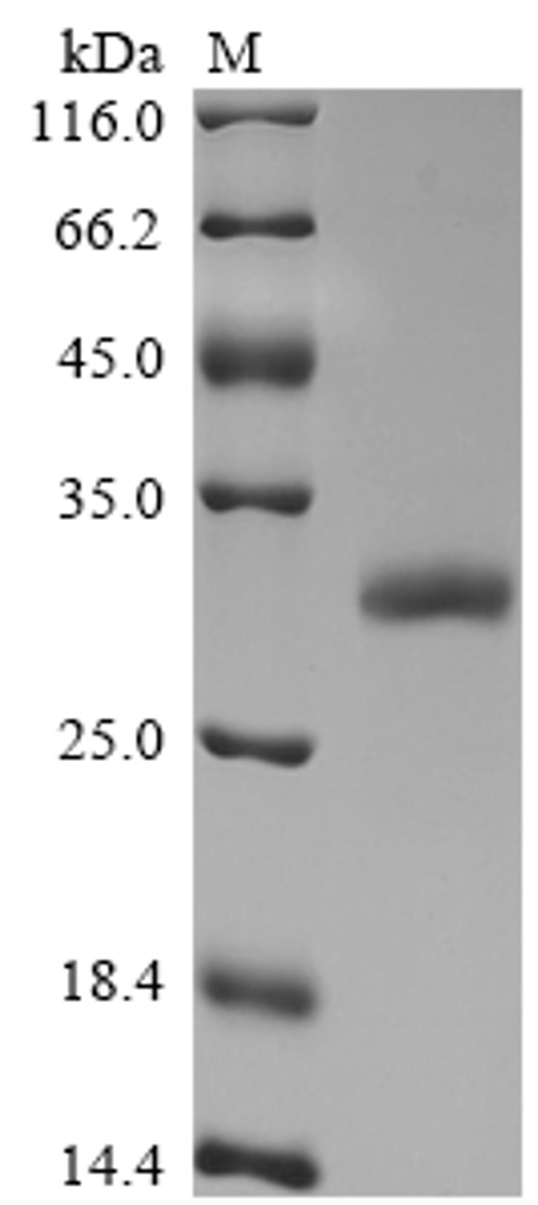 (Tris-Glycine gel) Discontinuous SDS-PAGE (reduced) with 5% enrichment gel and 15% separation gel.