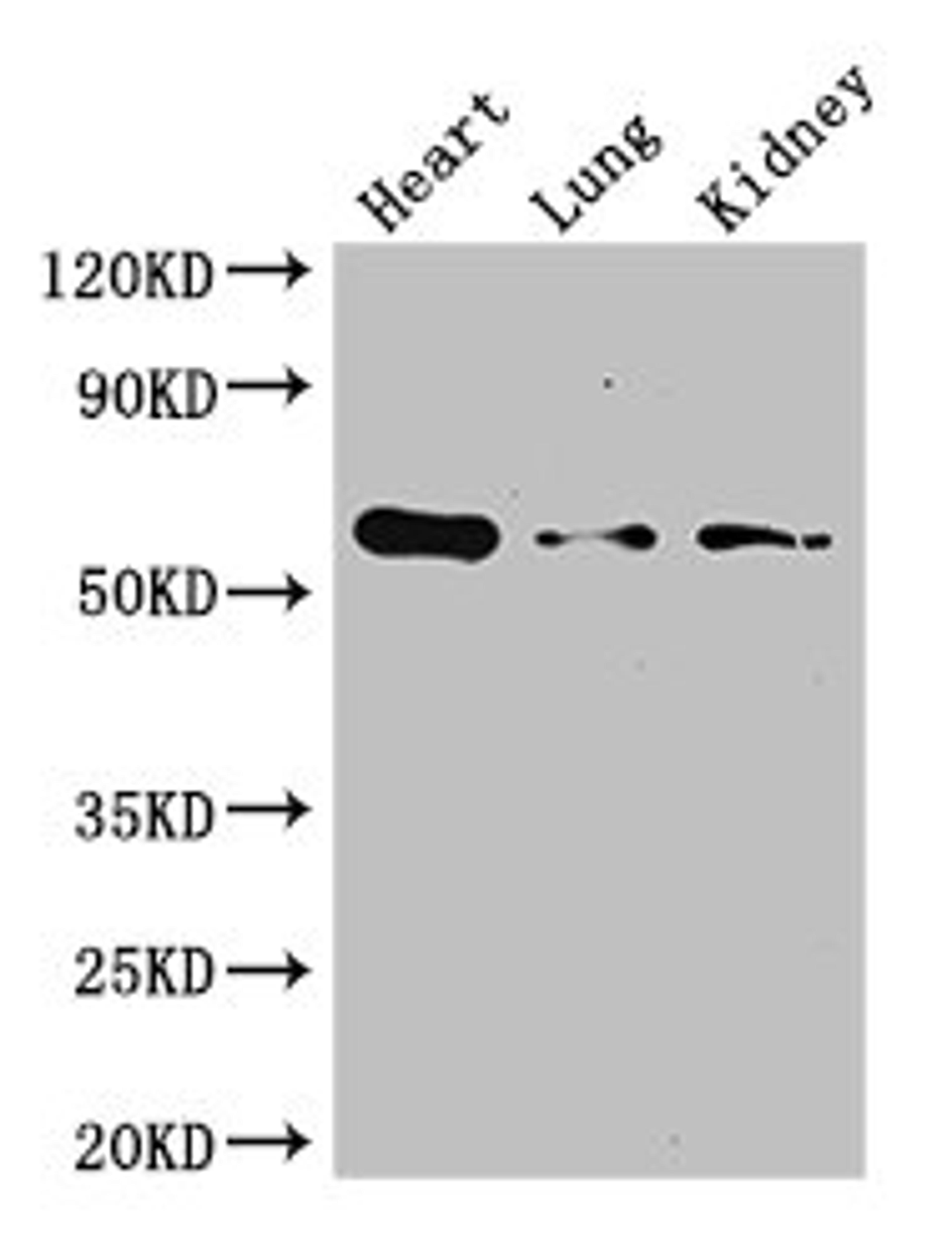 Western Blot. Positive WB detected in: Mouse heart tissue, Mouse lung tissue, Mouse kidney tissue. All lanes: Gcgr antibody at 3ug/ml. Secondary. Goat polyclonal to rabbit IgG at 1/50000 dilution. Predicted band size: 55 kDa. Observed band size: 55 kDa. 
