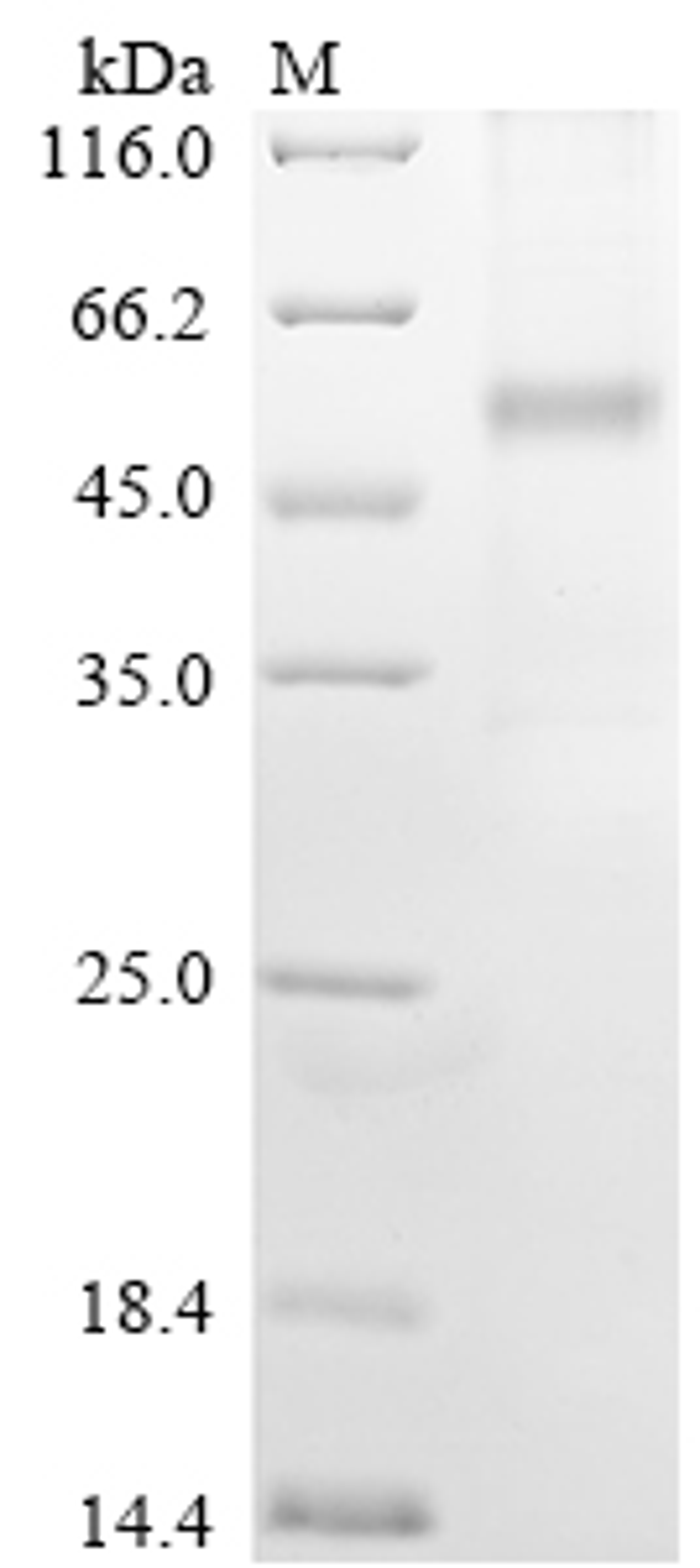 (Tris-Glycine gel) Discontinuous SDS-PAGE (reduced) with 5% enrichment gel and 15% separation gel.