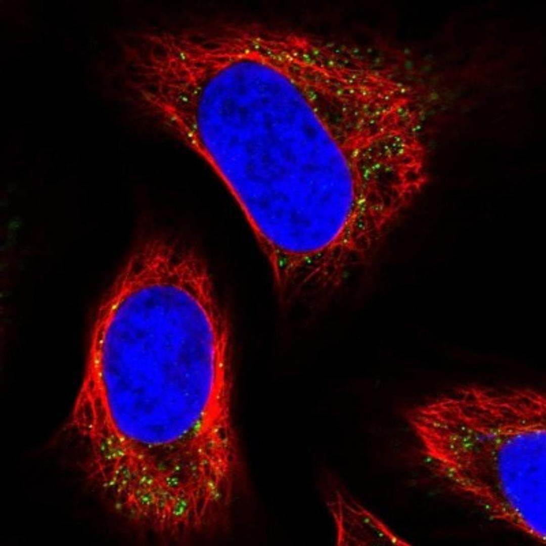 Immunocytochemistry/Immunofluorescence: OSBPL7 Antibody [NBP1-81054] - Staining of human cell line U-2 OS shows positivity in mitochondria.