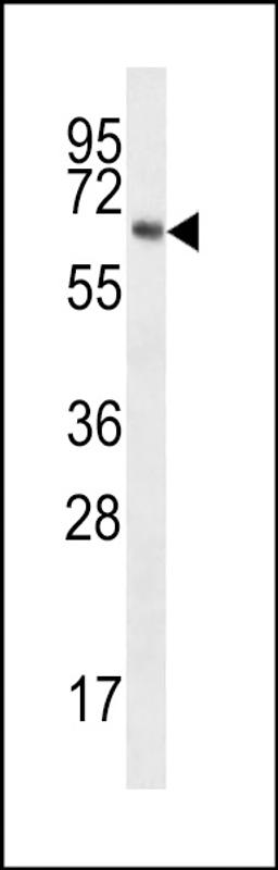 Western blot analysis in MDA-MB231 cell line lysates (35ug/lane).