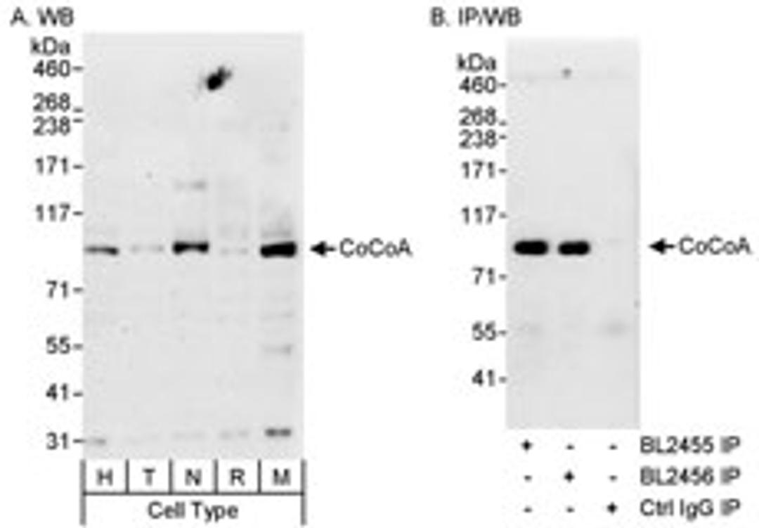 Detection of human and mouse CoCoA by western blot (h&m) and immunoprecipitation (h).