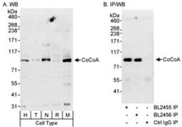 Detection of human and mouse CoCoA by western blot (h&m) and immunoprecipitation (h).