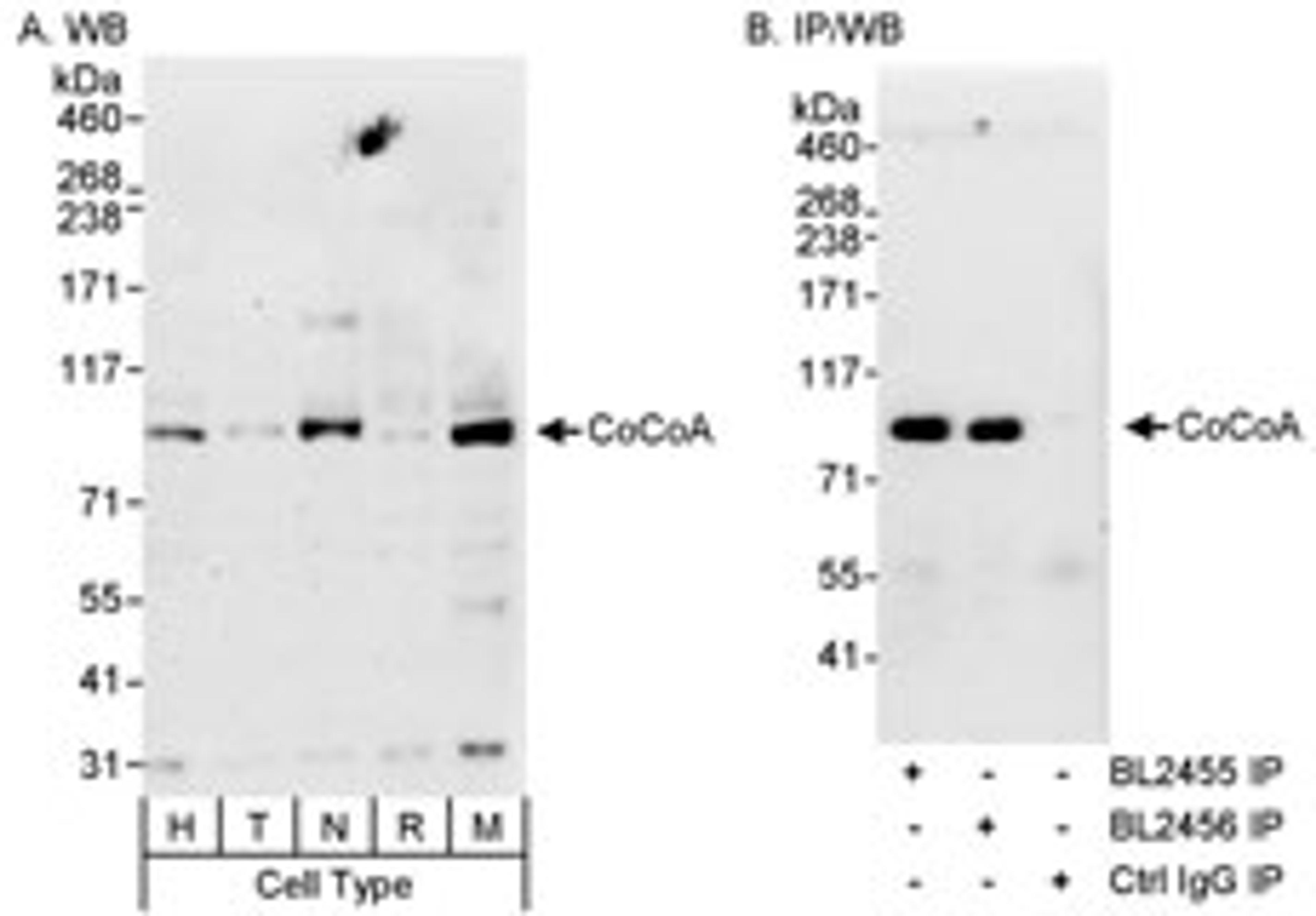 Detection of human and mouse CoCoA by western blot (h&m) and immunoprecipitation (h).