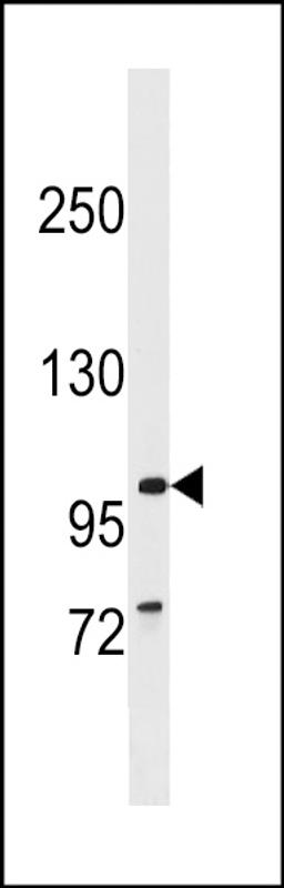 Western blot analysis in CEM cell line lysates (35ug/lane).