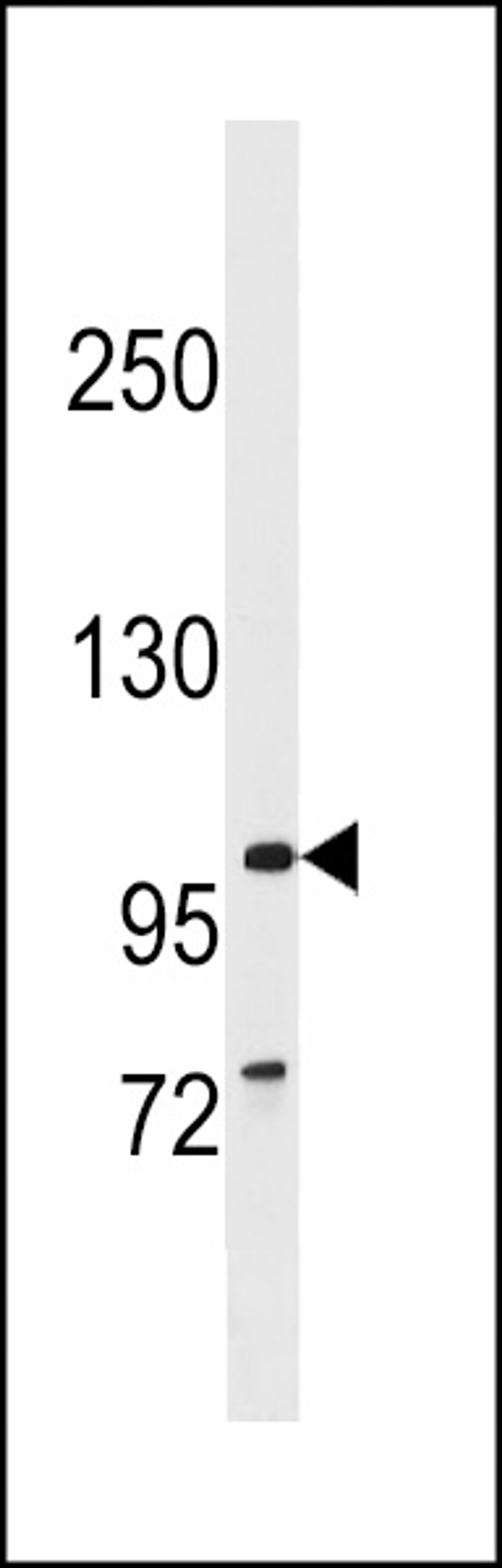 Western blot analysis in CEM cell line lysates (35ug/lane).