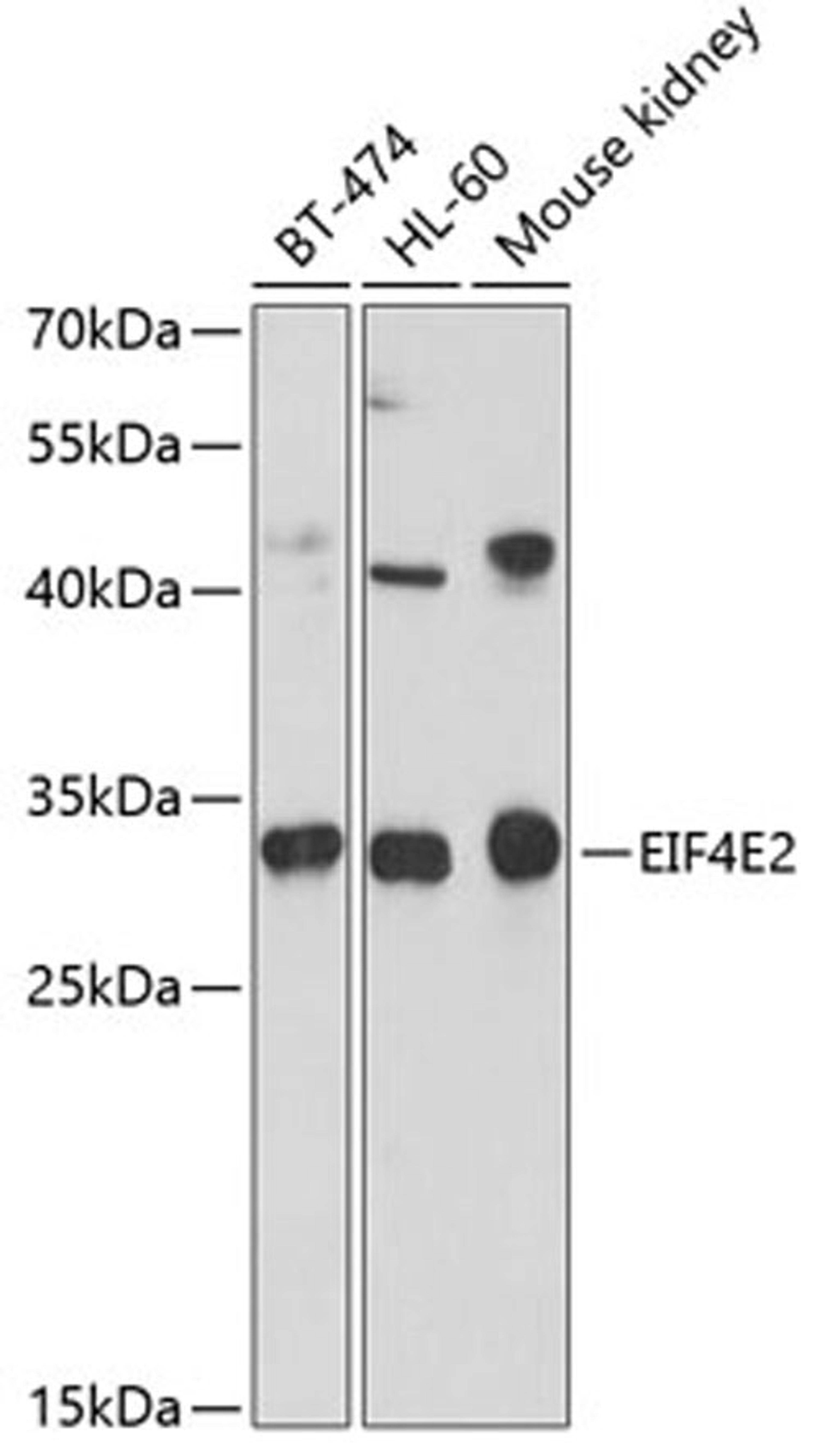 Western blot - EIF4E2 antibody (A4305)