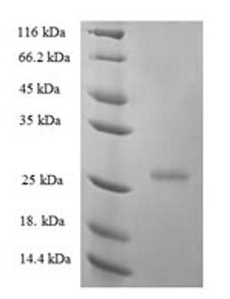 (Tris-Glycine gel) Discontinuous SDS-PAGE (reduced) with 5% enrichment gel and 15% separation gel.