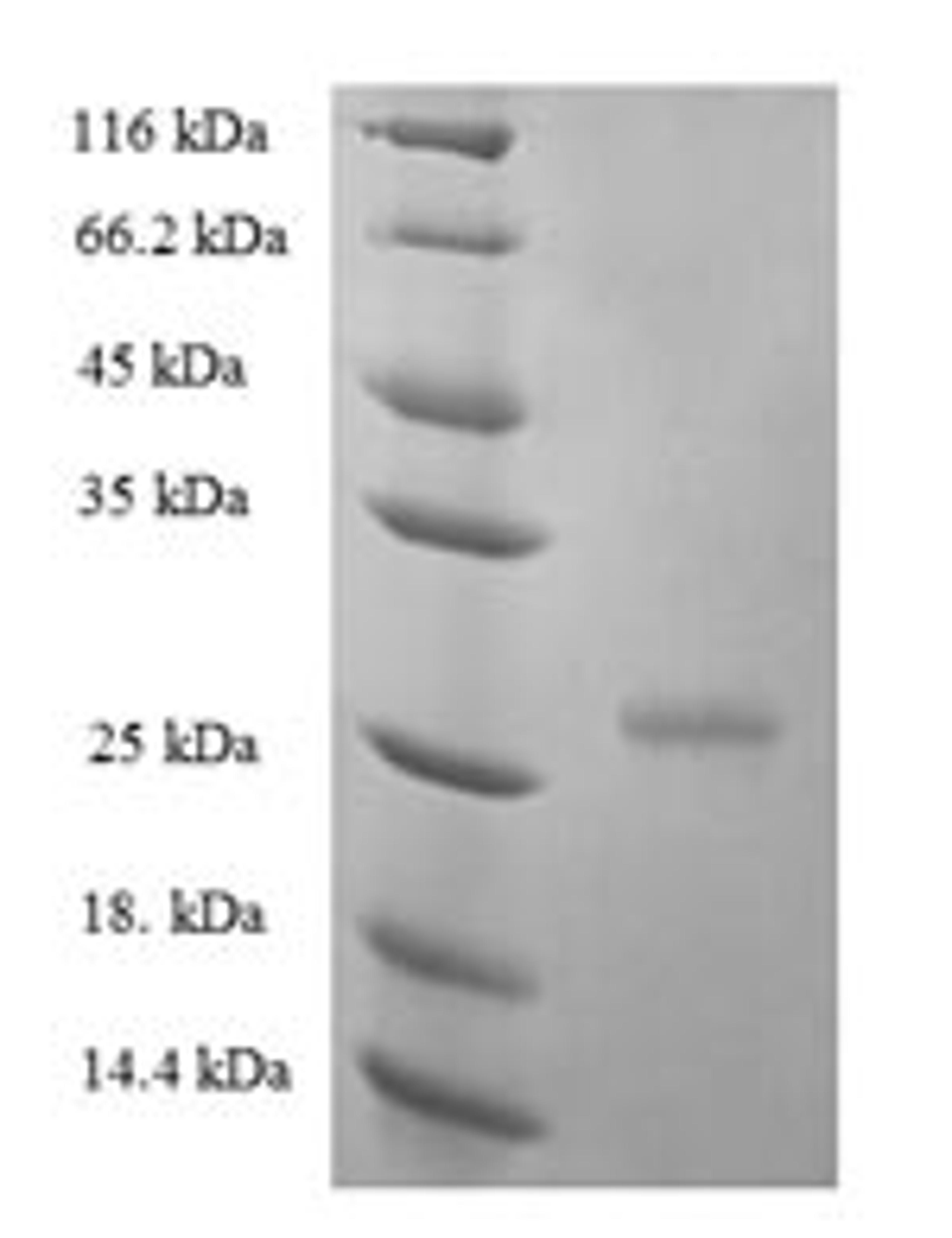 (Tris-Glycine gel) Discontinuous SDS-PAGE (reduced) with 5% enrichment gel and 15% separation gel.