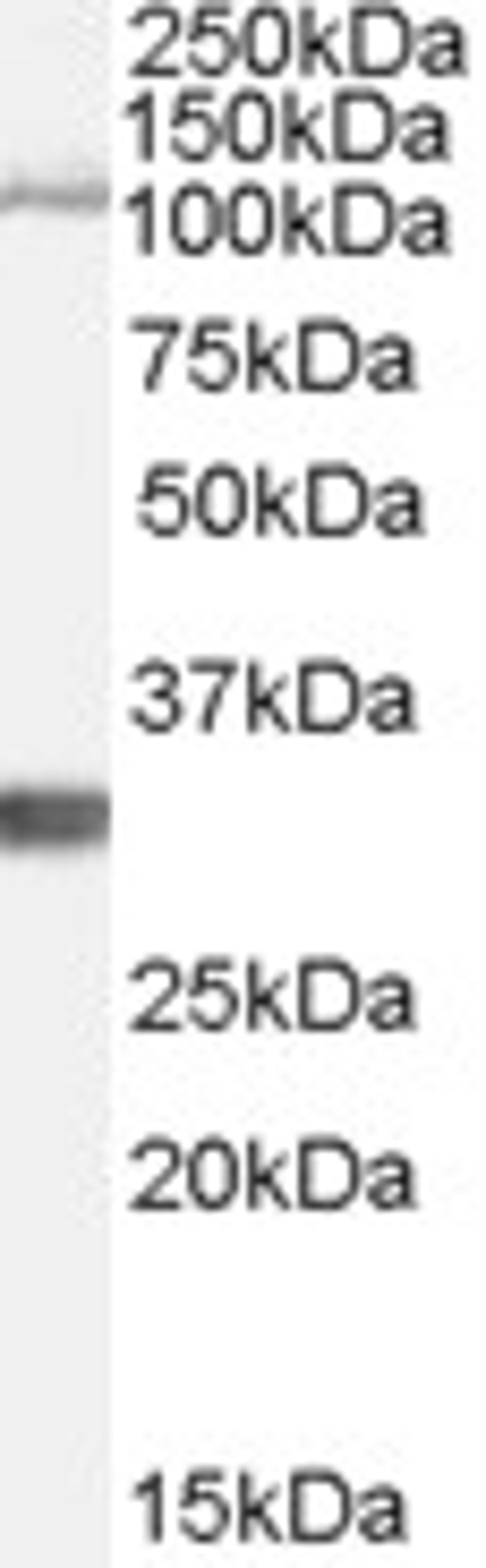 45-760 (1ug/ml) staining of Mouse Brain lysate (35ug protein in RIPA buffer). Primary incubation was 1 hour. Detected by chemiluminescence.