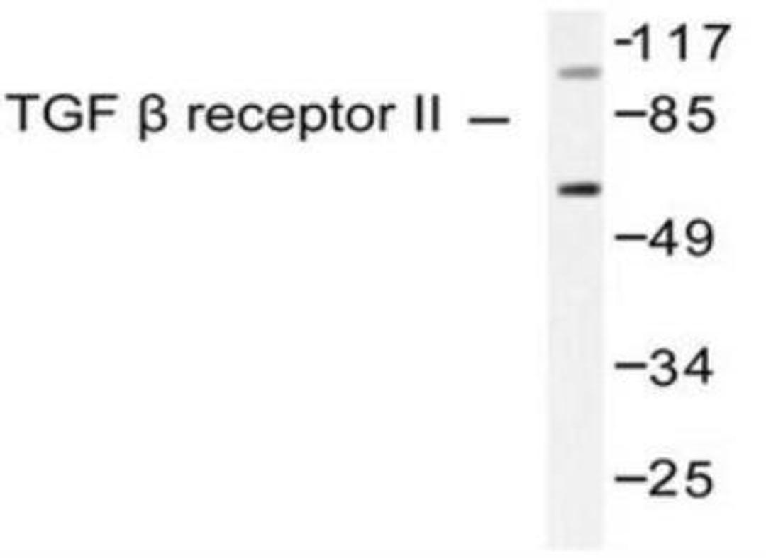 Western Blot: TGF beta Receptor II Antibody [NB100-91994] - Western blot (WB) analysis of TGF BETA  Receptor II (I122) pAb in extracts from HepG2 cells(65K) or LOVO cells(100K).