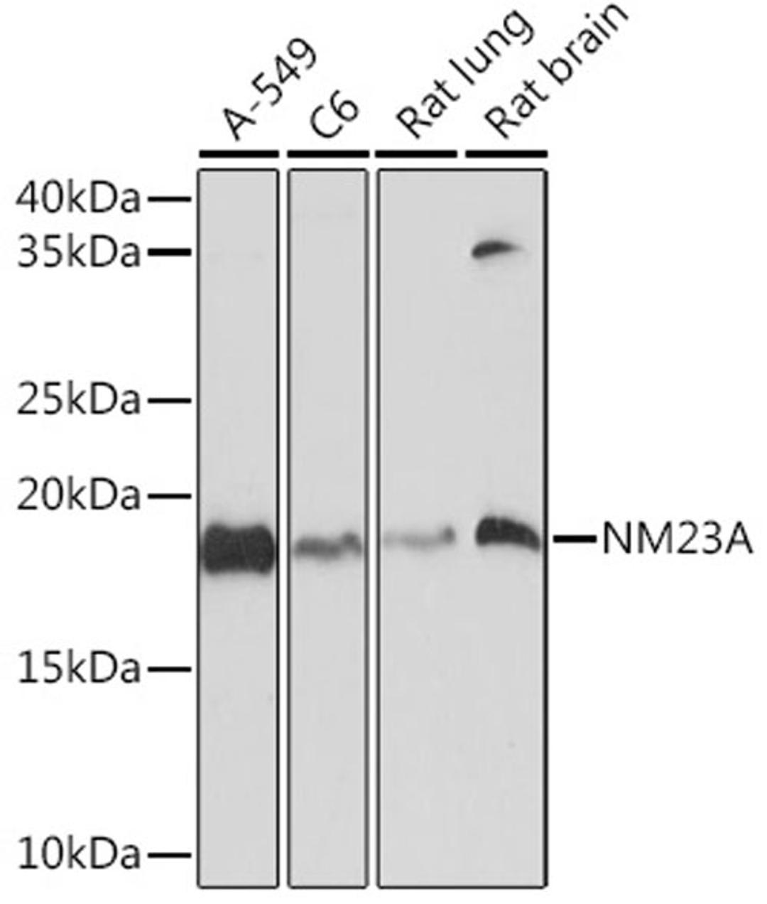 Western blot - NM23A Rabbit mAb (A8802)