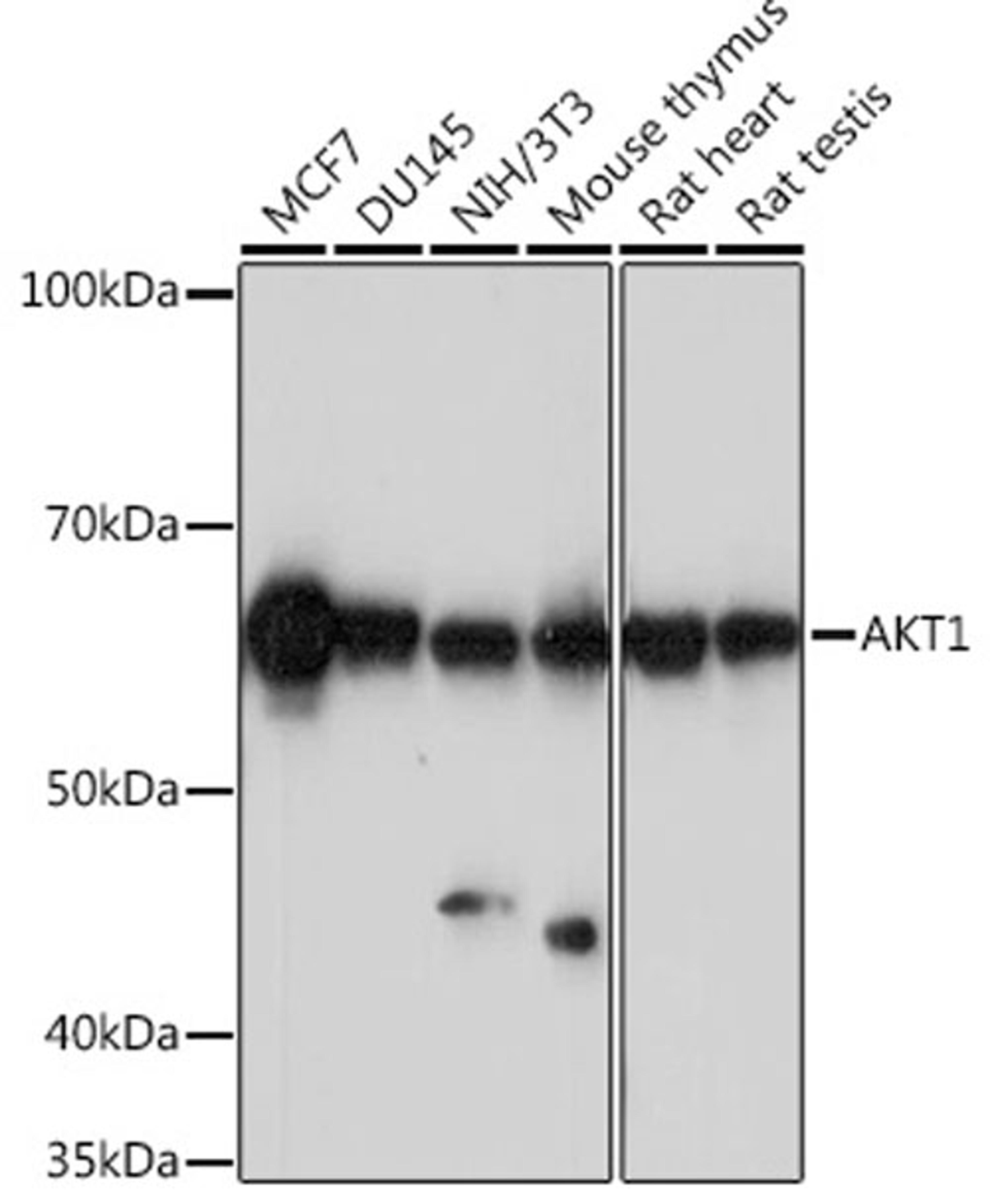 Western blot - AKT1 antibody (A17909)