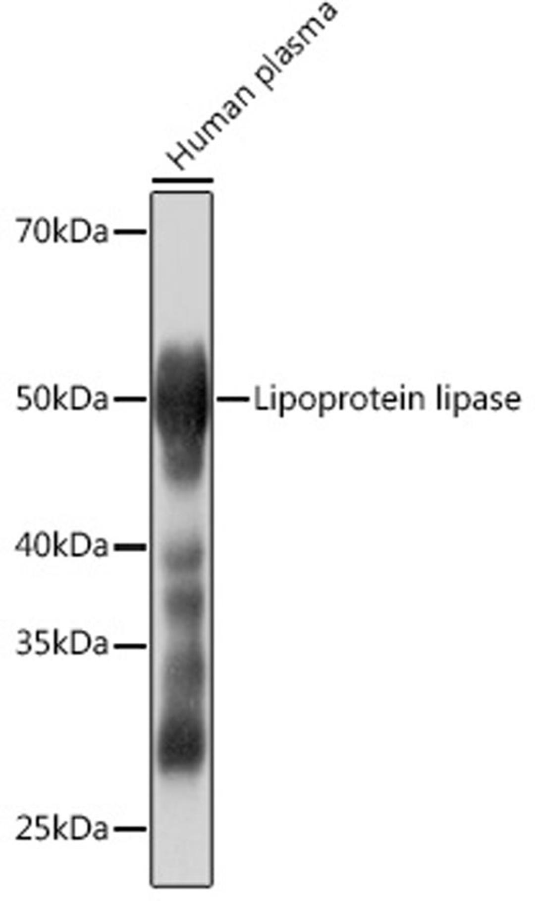 Western blot - Lipoprotein lipase Rabbit mAb (A4115)