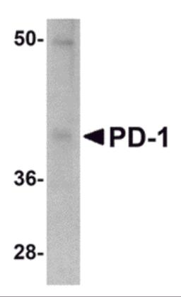 Western blot analysis of PD-1 in A-20 cell lysate with PD-1 antibody at 1 μg/mL.
