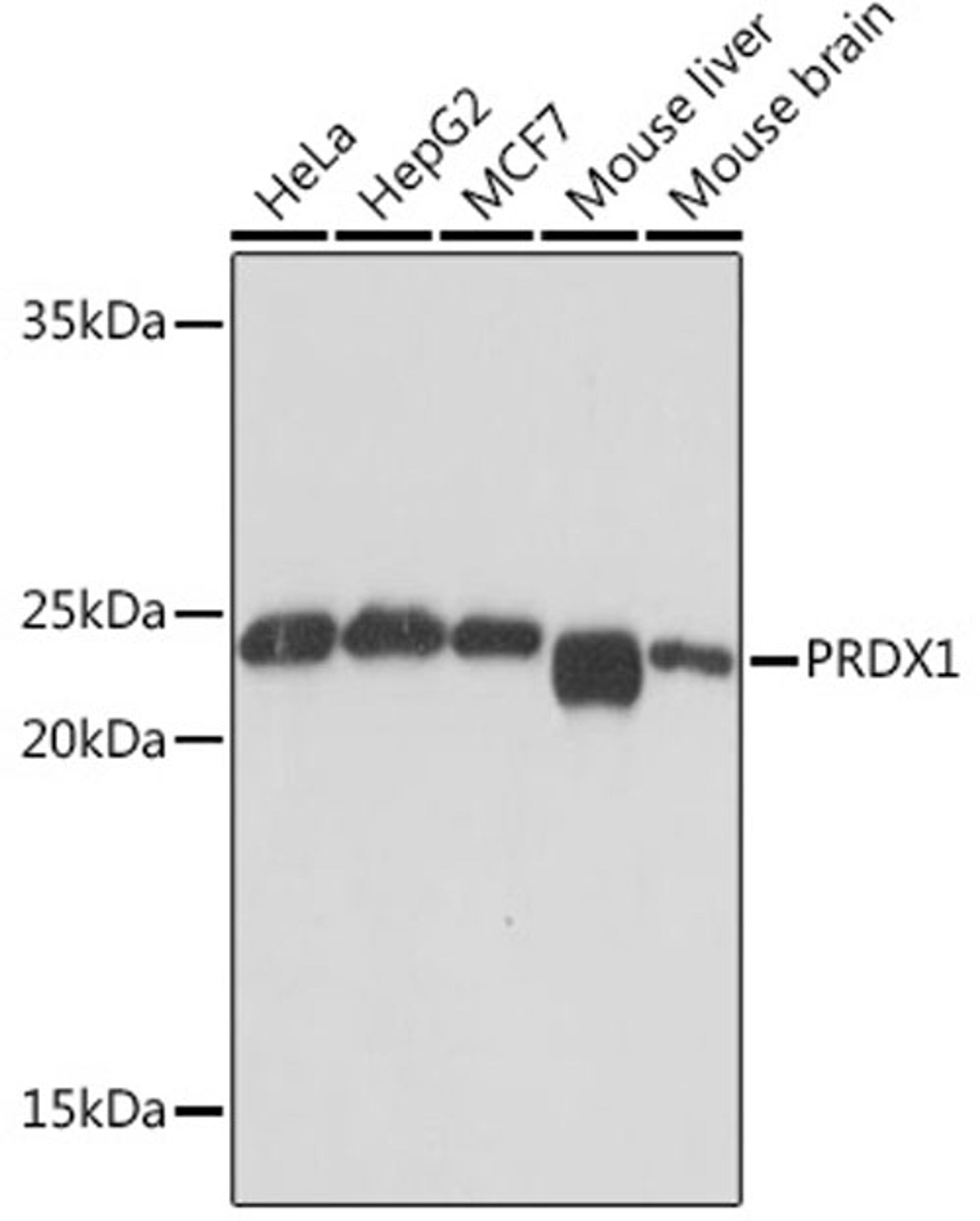 Western blot - PRDX1  Rabbit mAb (A4956)