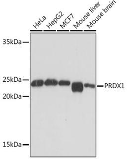 Western blot - PRDX1 Rabbit mAb (A4956)