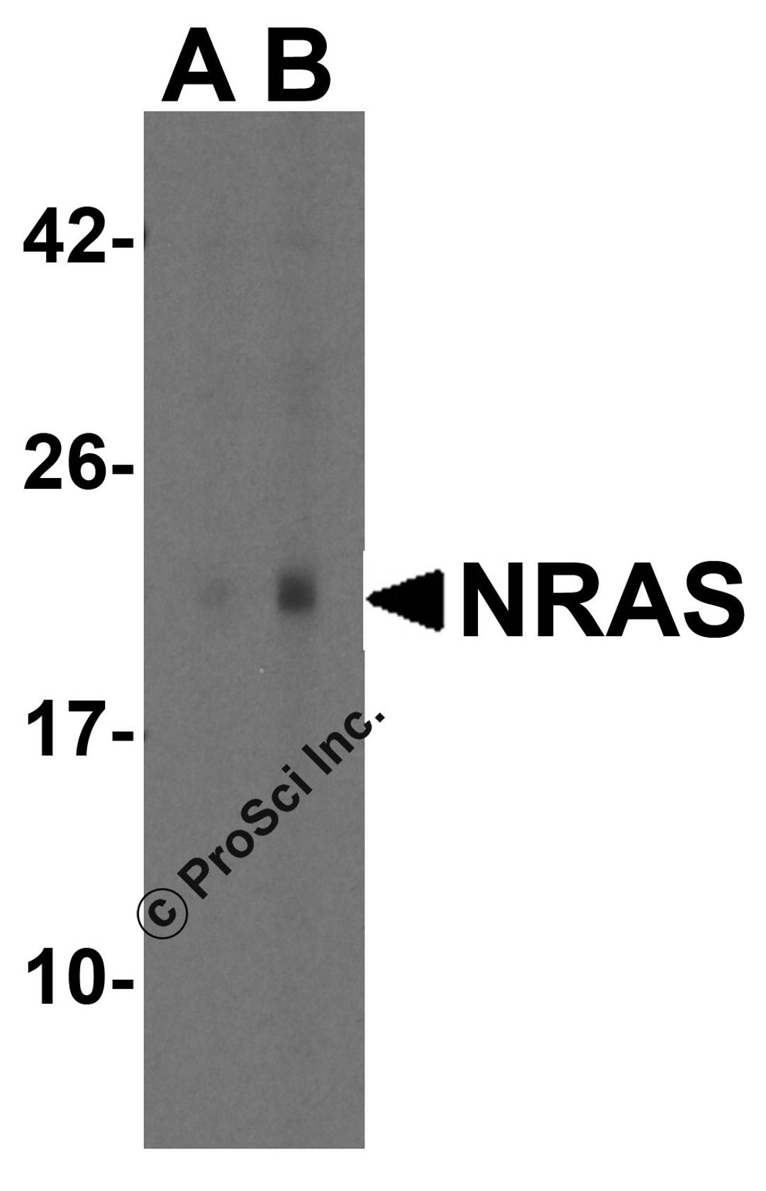Western blot analysis of NRAS in A431 cell lysate with NRAS antibody at (A) 1 and (B) 2 μg/mL.