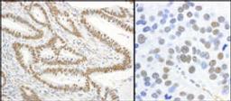 Detection of human and mouse Phospho-XRCC1-S485/T488 by immunohistochemistry.