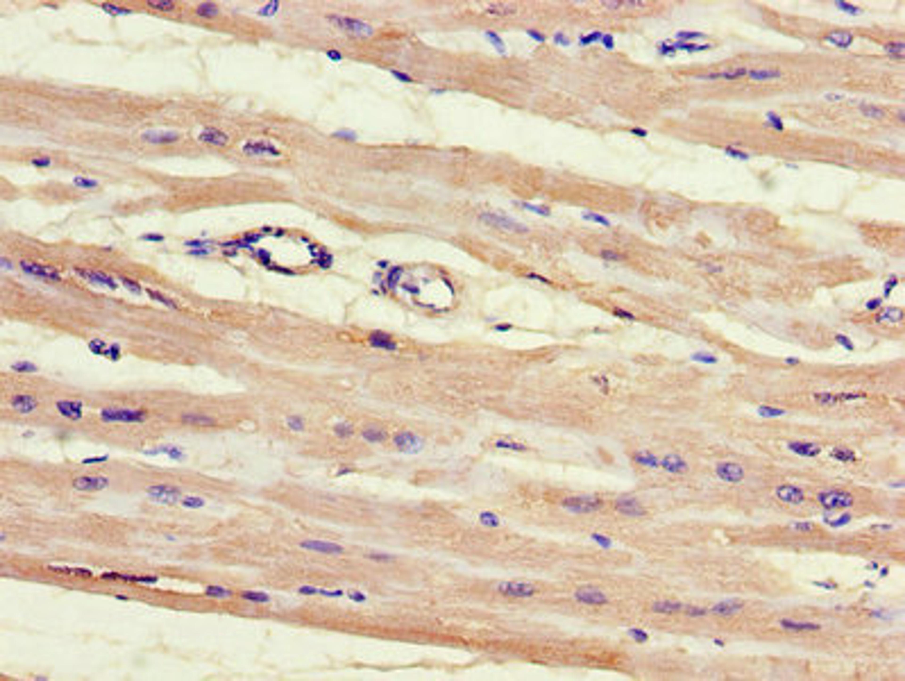 Immunohistochemistry of paraffin-embedded human heart tissue using CSB-PA010630LA01HU at dilution of 1:100