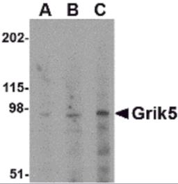 Western blot analysis of Grik5 in human brain tissue lysate with Grik5 antibody at (A) 0.5, (B) 1 and (C) 2 &#956;g/mL.