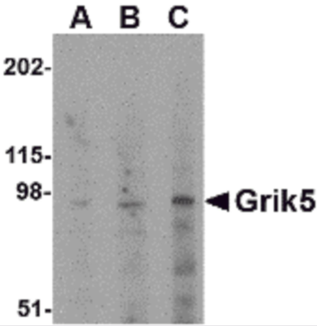 Western blot analysis of Grik5 in human brain tissue lysate with Grik5 antibody at (A) 0.5, (B) 1 and (C) 2 μg/mL.