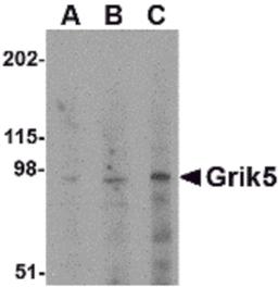 Western blot analysis of Grik5 in human brain tissue lysate with Grik5 antibody at (A) 0.5, (B) 1 and (C) 2 μg/mL.