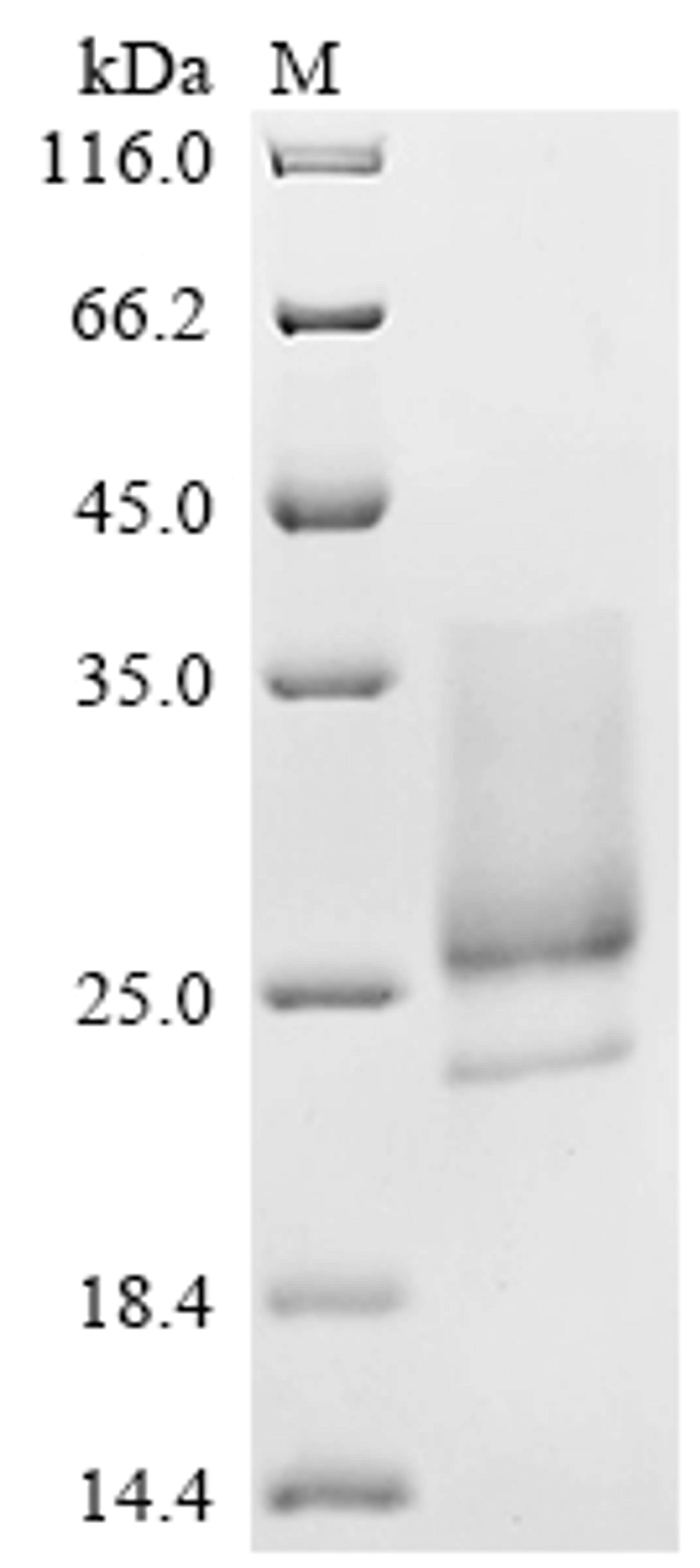 (Tris-Glycine gel) Discontinuous SDS-PAGE (reduced) with 5% enrichment gel and 15% separation gel.