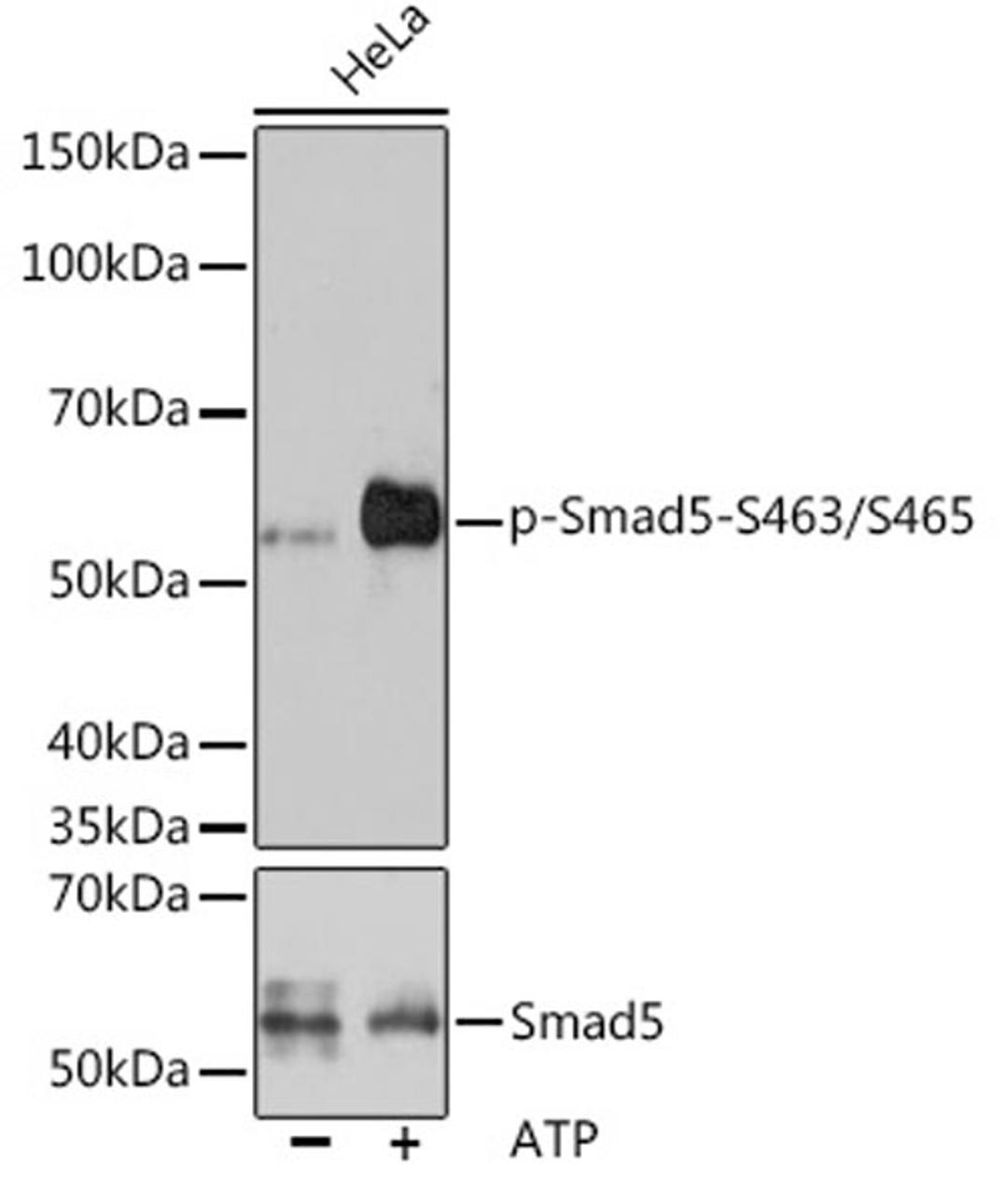 Western blot - Phospho-Smad5-S463/S465 antibody (AP1023)